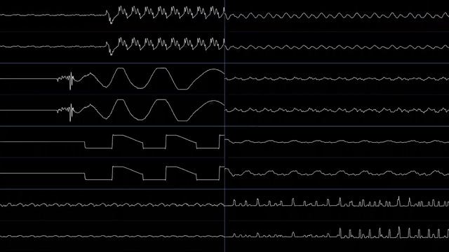 Ahrion - Frequencies in Flux (Oscilloscope View) смотреть онлайн