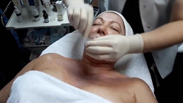 Процедура ТСА GIGI