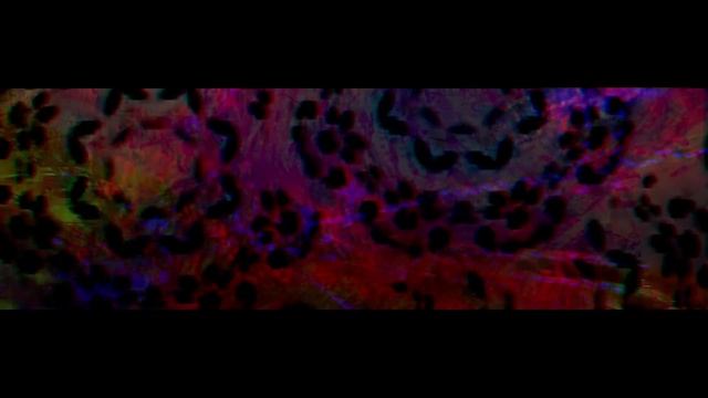 The Twin - Where Are We Now? смотреть онлайн