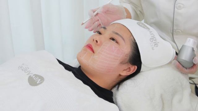 Ultraformer 7D HIFU Treatment Explanation