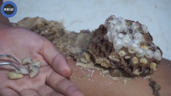 Dandruff scratching and satisfying picking Worm #636