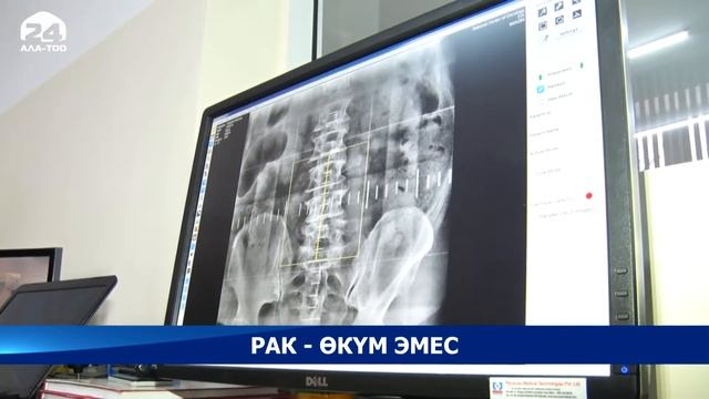 Кыргызстанда жылына 5 миңден ашуун адам рак оорусуна чалдыгат смотреть онлайн