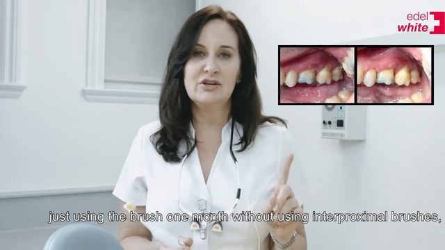 edel+white Sonic Generation SG8 toothbrush for professionals смотреть онлайн