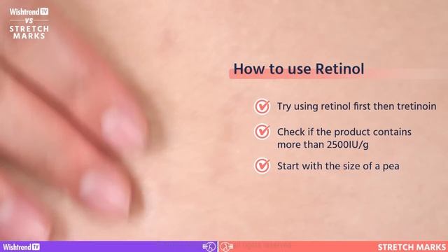 Which one is better, Retinol A or Vitamin A? | Stretch Marks Master Class PART.2 смотреть онлайн