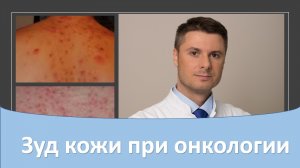 Зуд кожи при онкологии.
