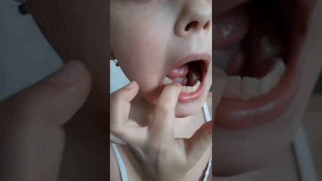 Вырвать #зуб без #боли и #страха как #игра смотреть онлайн