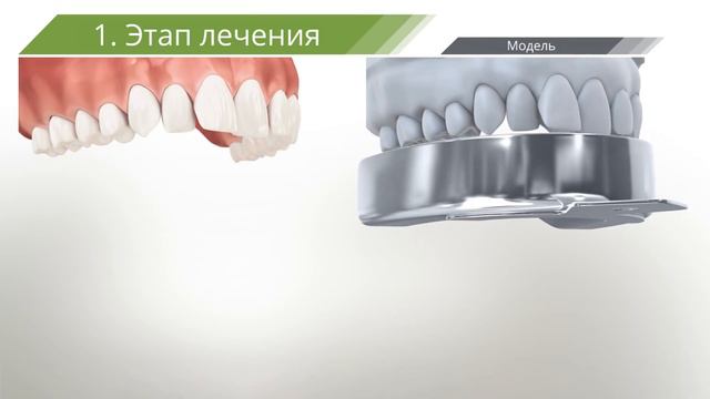Ведущий ортодонт клиники Eurokappa смотреть онлайн