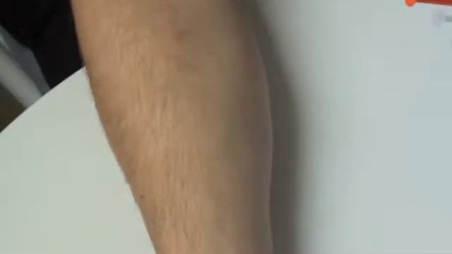 Как за 15 минут узнать, есть ли у вас аллергия смотреть онлайн