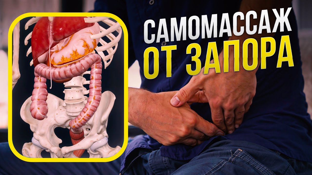 Как избавиться от запора и вздутия живота быстро и легко БЕЗ слабительных? Самомассаж от запора смотреть онлайн