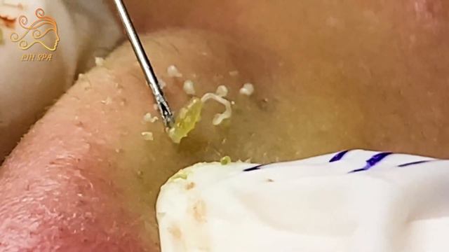 Enjoy Every Day With The Best Video Loan Nguyen Spa New Office #Spa017 смотреть онлайн