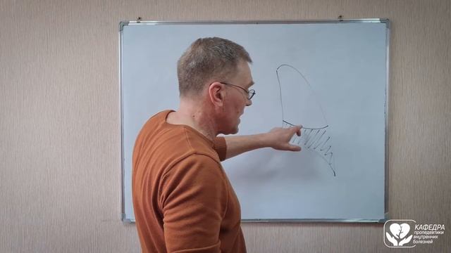 Обтурационный ателектаз