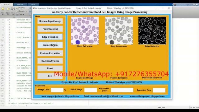 Top 10 Matlab Projects Source Code || Top 10 Final Year Project Code || Top 10 Major Project Code смотреть онлайн