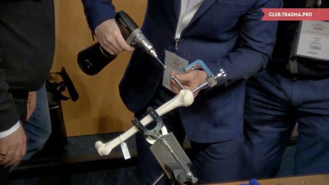 Интрамедуллярный остеосинтез переломов проксимального плеча системой MultiLoc смотреть онлайн