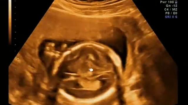 моё узи 2009 год 18 недель часть 3 смотреть онлайн