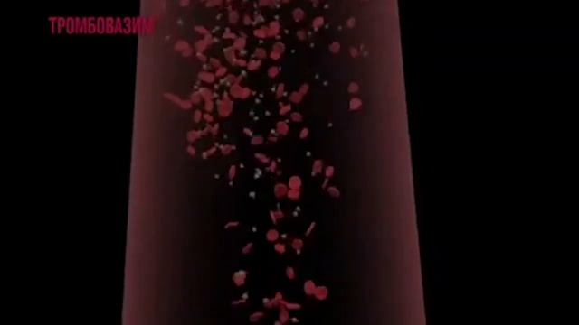 Инновационные технологии в лечении тромбоза смотреть онлайн