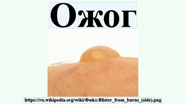 Ожог смотреть онлайн