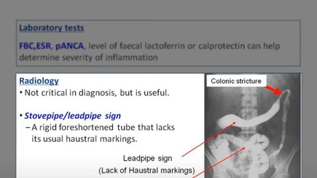 Ulcerative Colitis смотреть онлайн