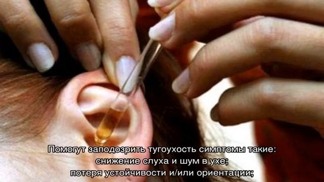 Что такое тугоухость и ее симптомы смотреть онлайн