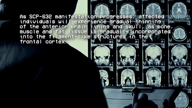Intrusive Arachnid Thoughts - SCP-632 [EUCLID] смотреть онлайн
