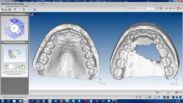 MAESTRO 3D ORTHO STUDIO VERSION 2 DEMONSTRATION