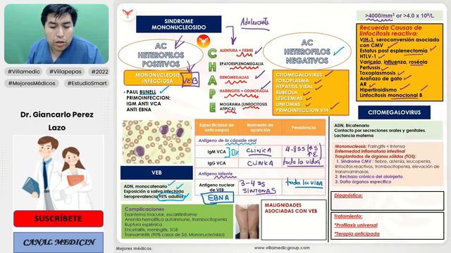 INFECCIONES VIRALES PARTE 3 - SÍNDROME MONONUCLEOSIDO, CITOMEGALOVIRUS, VEB- INFECTOLOGÍA VILLAMEDI смотреть онлайн