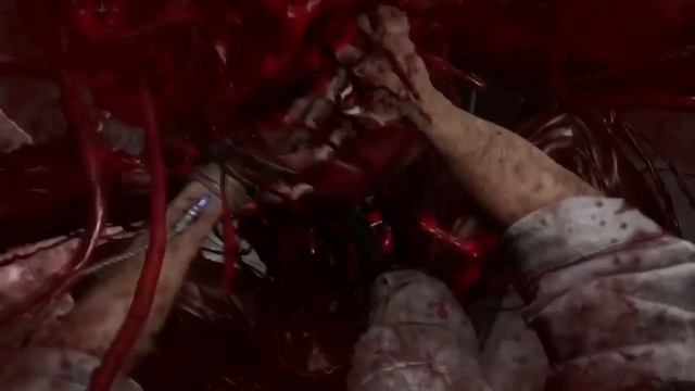 Белый Вагон - Откуда мем? смотреть онлайн