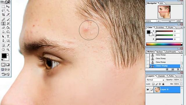 Remove Pimple Marks For Oily Skin Photoshop Plugins смотреть онлайн