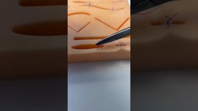 Наложение швов после лапароскопии / Suturing After Laparoscopy