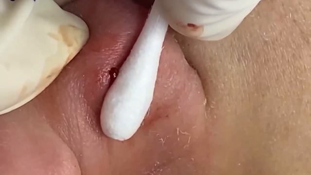 Enjoy Every Day With Nhat Bang Spa New Videos #2002