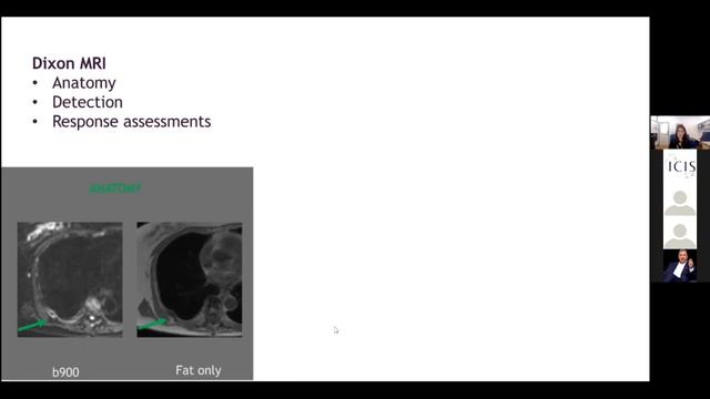 Whole-body MRI: review of MET-RADS, MY-RADS & ONCO-RADS. Dr Messiou & Profs Padhani, Petralia & Koh смотреть онлайн