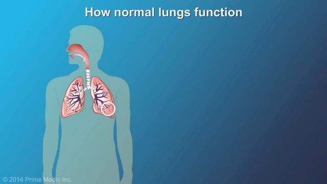 Understanding COPD