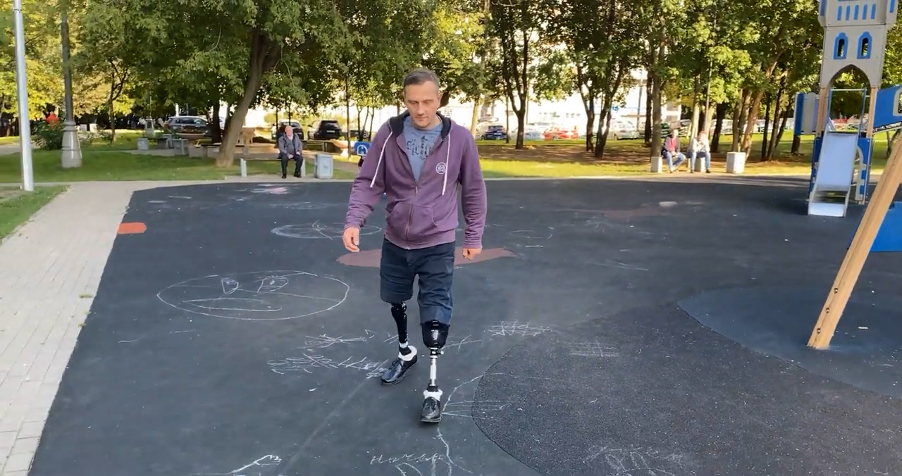 Как я хожу после двусторонней ампутации ног. смотреть онлайн