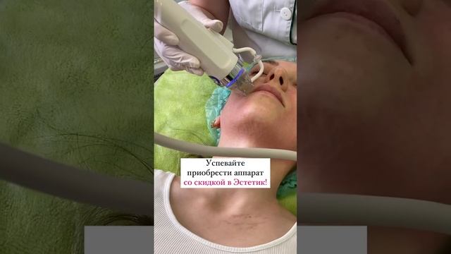Впечатляющий результат с первых же сеансов! Микроигольчатый RF - новейшая методика подтяжки кожи смотреть онлайн