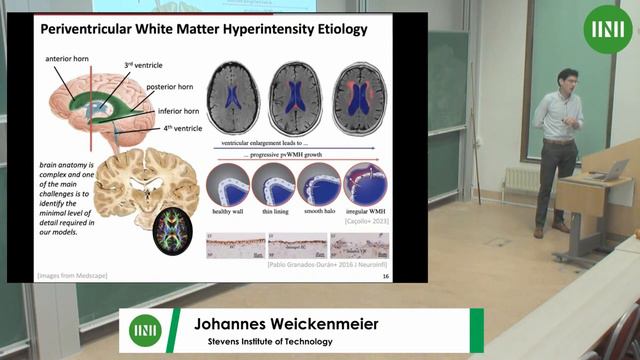 Dr. Johannes Weickenmeier | A multiphysics model to predict periventricular white matter... смотреть онлайн
