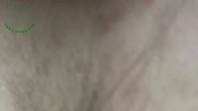 Remover Big Blackhead In Ear