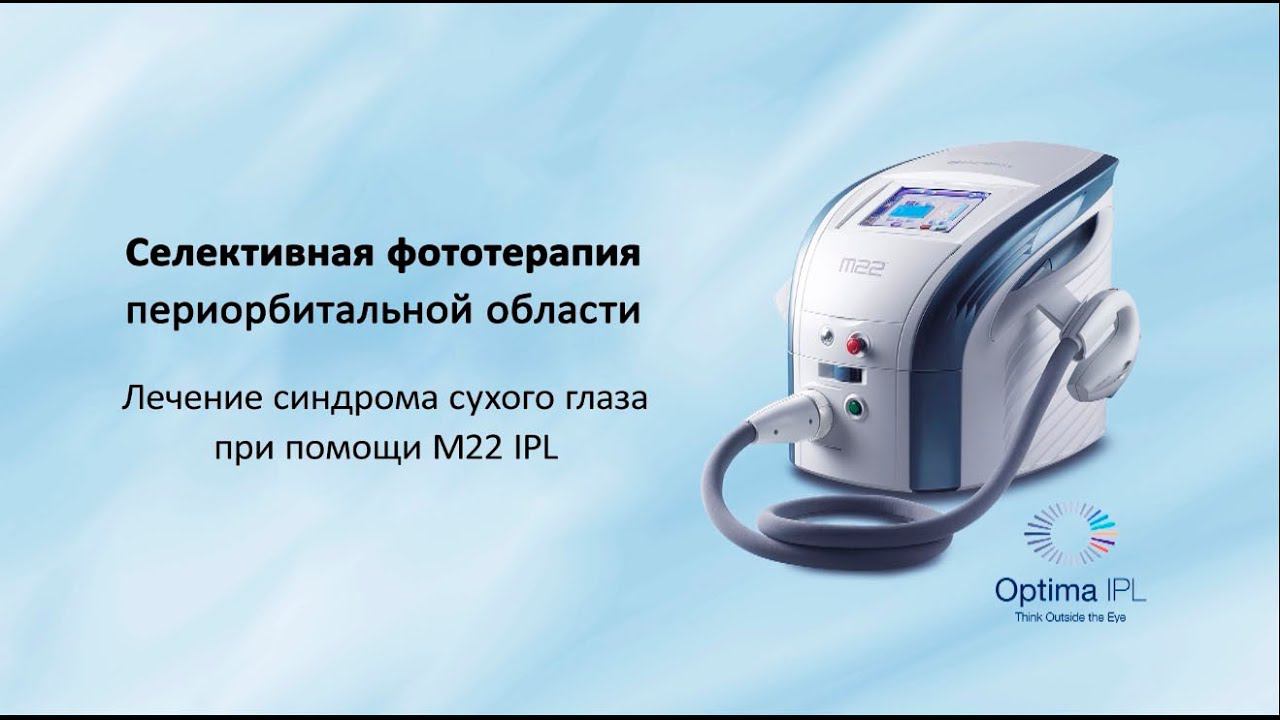 Лечение синдрома сухого глаза с IPL M22 (Optima IPL)
