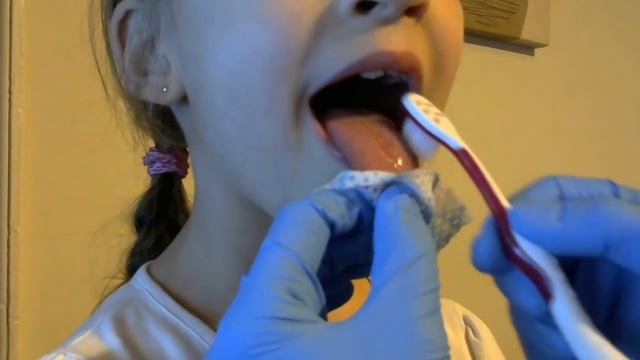 Логопедический массаж в домашних условиях смотреть онлайн