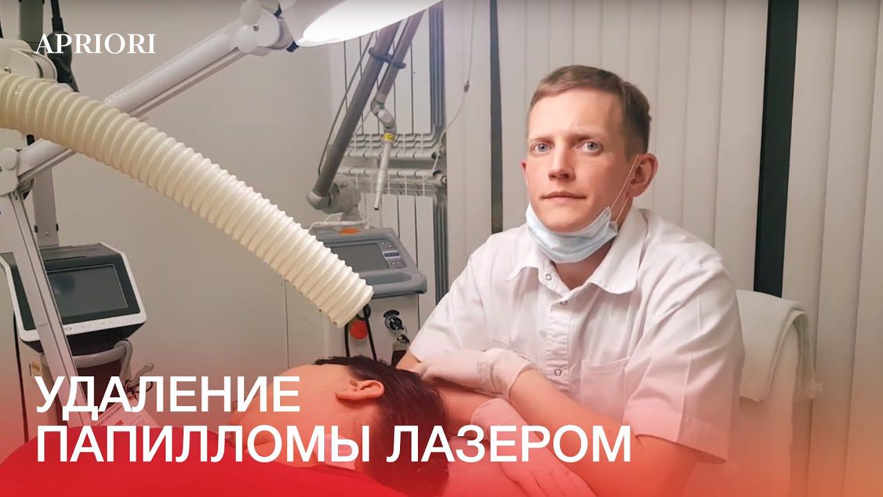 Удаление папилломы лазером в Дзержинске смотреть онлайн
