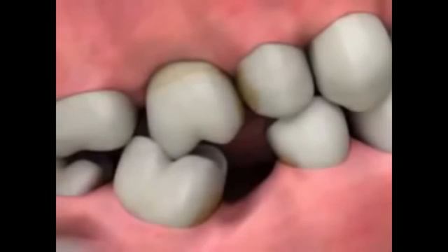 Феномен Попова Годона смотреть онлайн