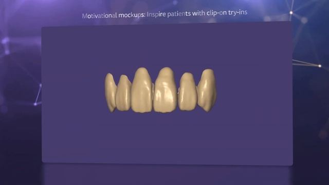 exocad DentalCAD смотреть онлайн
