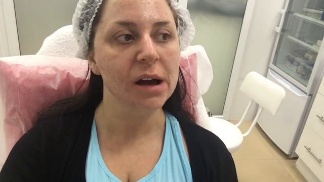 КАК ИЗБАВИТЬСЯ ОТ ВТОРОГО ПОДБОРОДКА ЗА 1 ДЕНЬ ! ЛИПОЛИТИКИ. смотреть онлайн