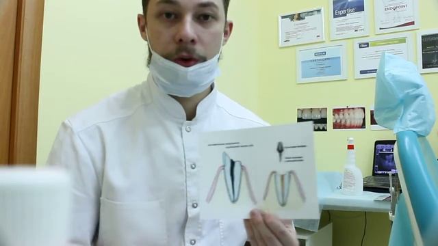 12 выпуск .Скажите доктор : что такое культевая владка ? зачем нужна культевая вкладка? смотреть онлайн