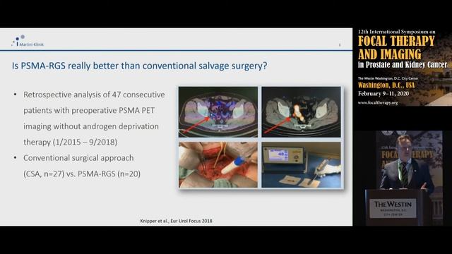 65 Doctor Georg Salomon Germany Radio guided surgery смотреть онлайн
