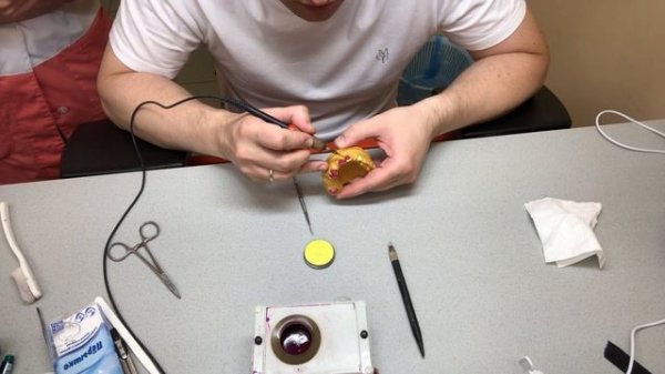 Изготовление восковой композиции  под литьё под металлокерамики | Dr Vitali Nosov |  #зубнойтехник