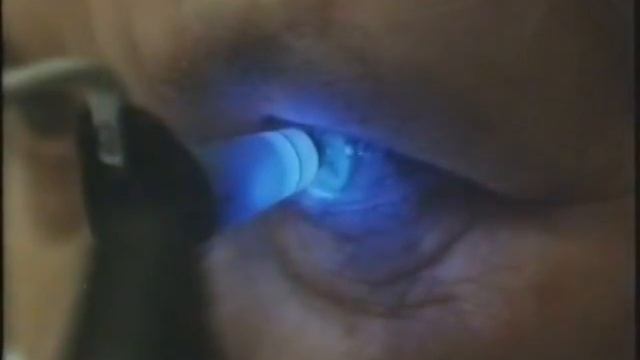 Обследования органа зрения © Study eye смотреть онлайн