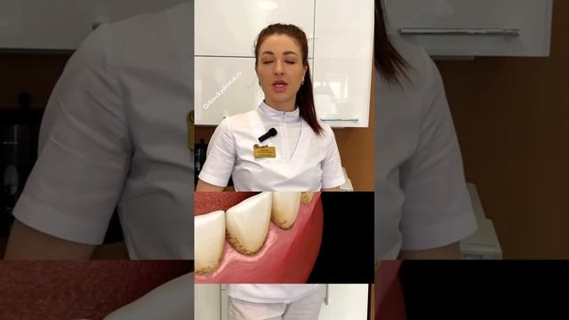 ?️? Защити зубы от кариеса вместе со стоматологией Orlovskydental Правобережье, г. Калуга? смотреть онлайн