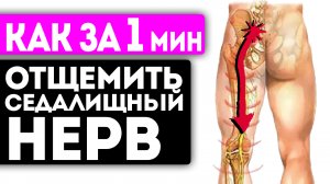 Ишиас как растворился! Смотрите, как я за 1 мин сделал эти движения и разблокировал седалищный нерв
