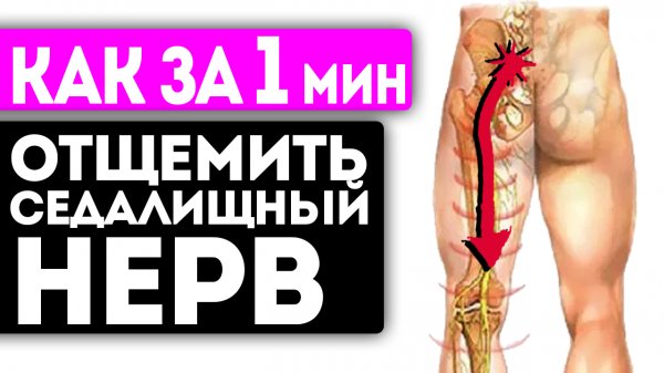 Ишиас как растворился! Смотрите, как я за 1 мин сделал эти движения и разблокировал седалищный нерв