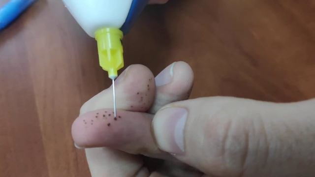 Сравнение Pelsar и других plasma pen смотреть онлайн