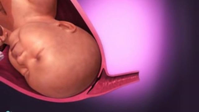 Удивительный механизм естественных родов смотреть онлайн